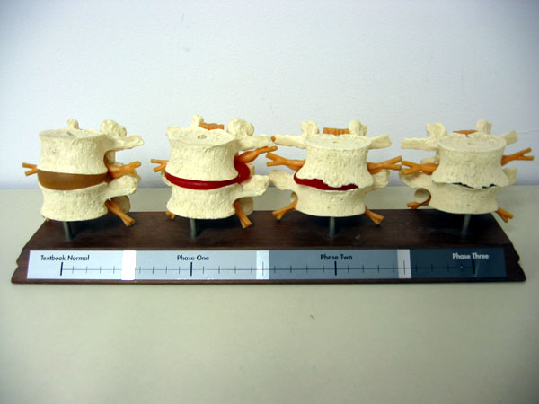 Importance of Vitamin D to the Spine 1 bonehealth